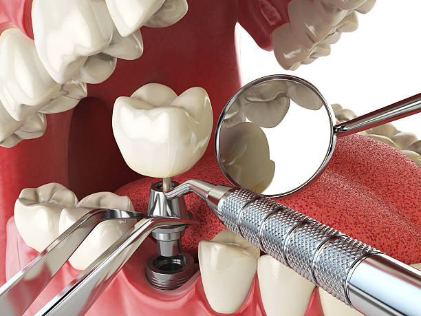 Best Emergency Treatment for Toothache in Summerville, GA