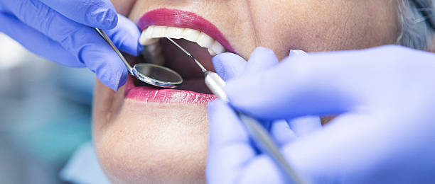 Best Walk-In Emergency Dentist in Summerville, GA